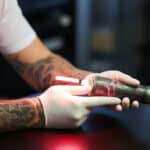 Tattoo Removal Cost Calculator: An In-Depth Analysis